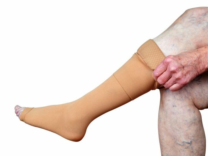 Elderly Womans' Leg with Compression Stocking on in Bluefield, VA, Covington, Martinsville, Roanoke, VA, Westlake Corner, Wytheville, VA